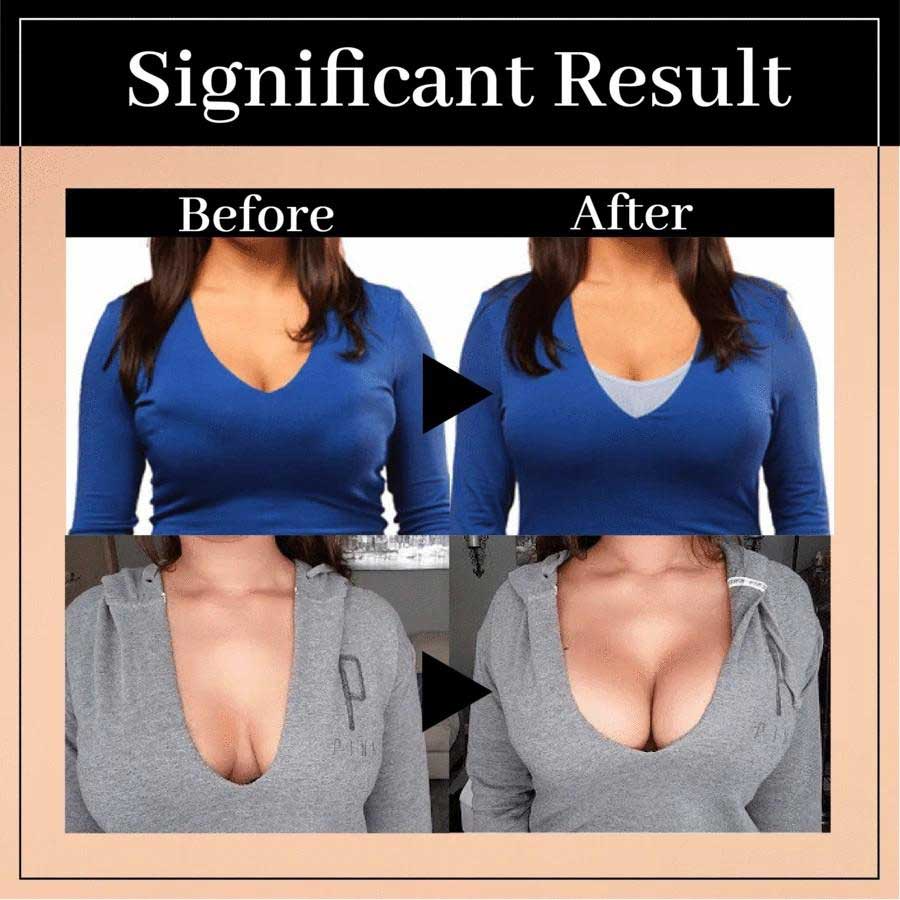 Posture Support Corrector Support Boost Bra Front Closure Bra Plus Size For Women