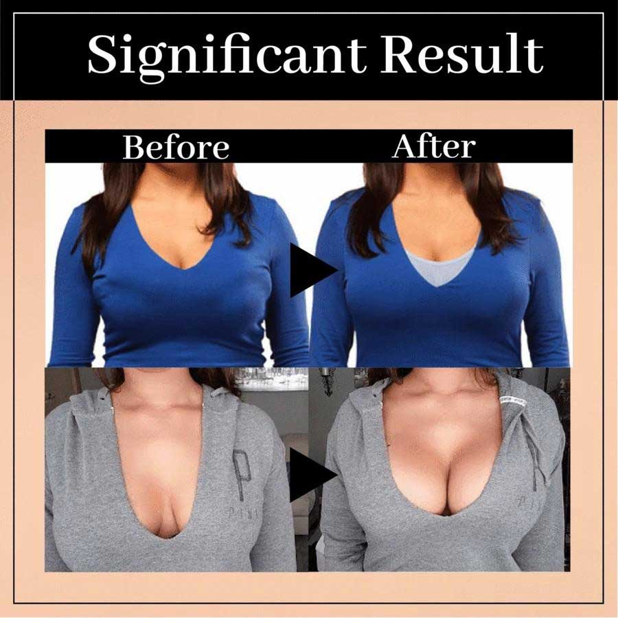 Posture Support Corrector Boost Bra Front Closure Bra Plus Size For Women