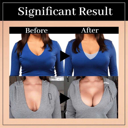 Posture Support Corrector Boost Bra Front Closure Bra Plus Size For Women